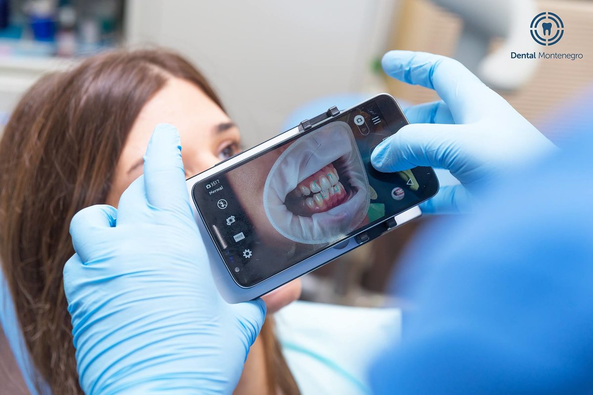 Dental Montenegro - Dental Montenegro