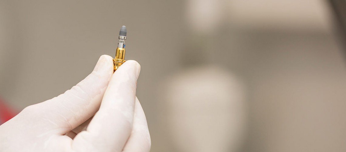 Dental Montenegro - Dental Montenegro