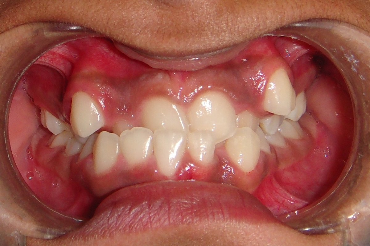 Dental Pearl Orthodontic & Periodontic center - Dental Pearl Orthodontic & Periodontic center