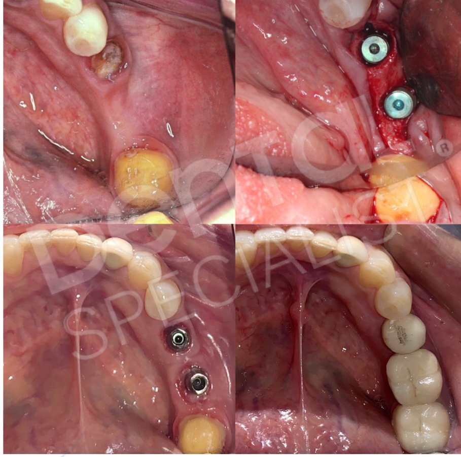 Dental Specialist Acuna - Dental Specialist Acuna