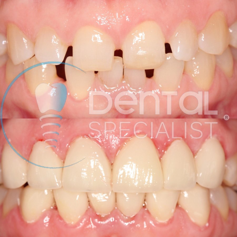 Dental Specialist Acuna - Dental Specialist Acuna