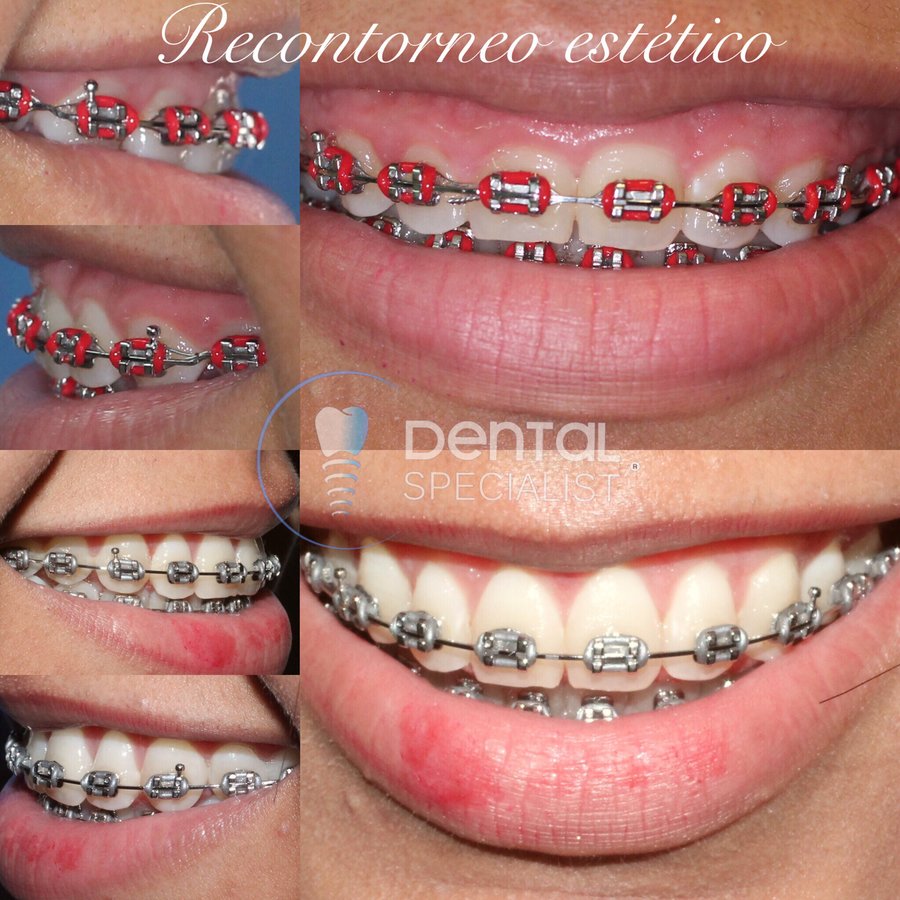 Dental Specialist Acuna - Dental Specialist Acuna