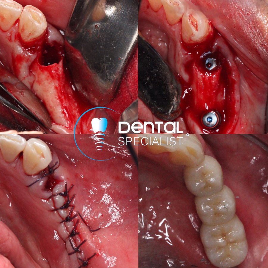 Dental Specialist Acuna - Dental Specialist Acuna