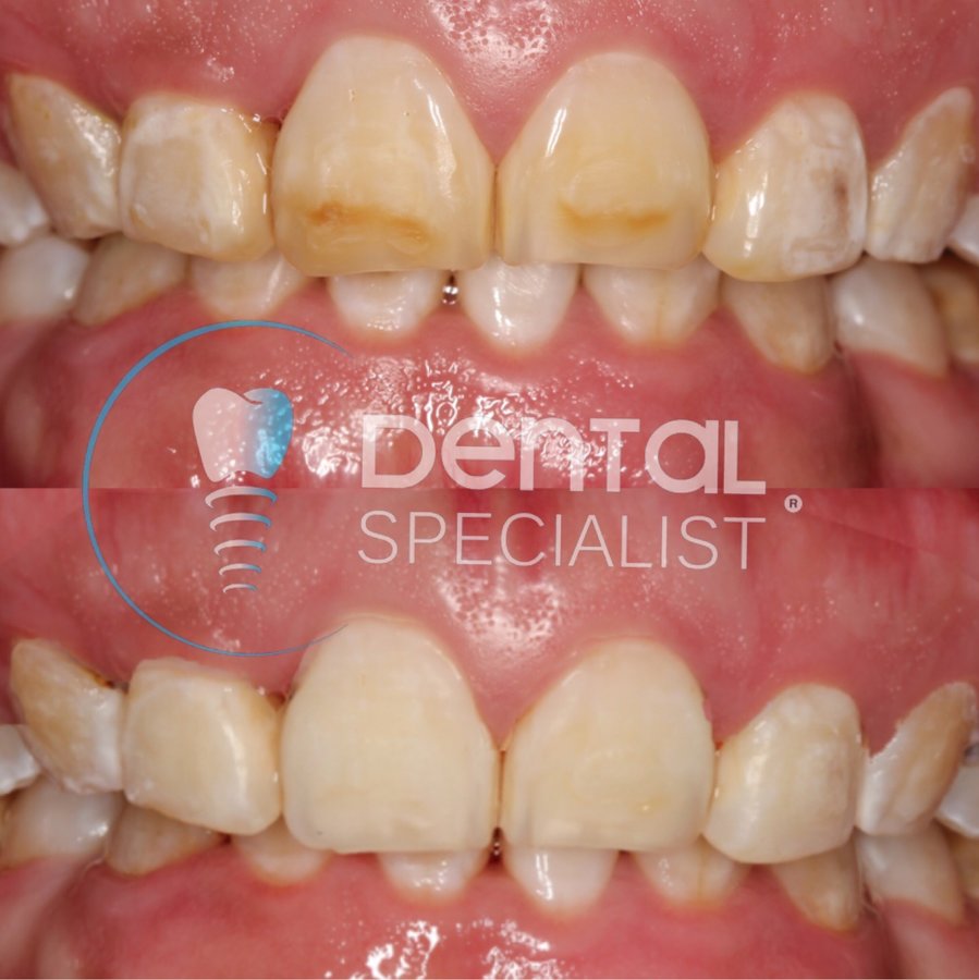 Dental Specialist Acuna - Dental Specialist Acuna