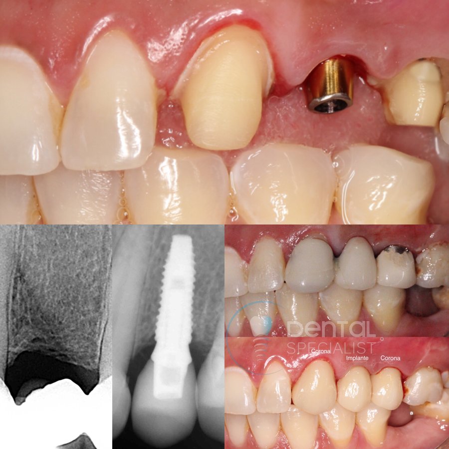 Dental Specialist Acuna - Dental Specialist Acuna