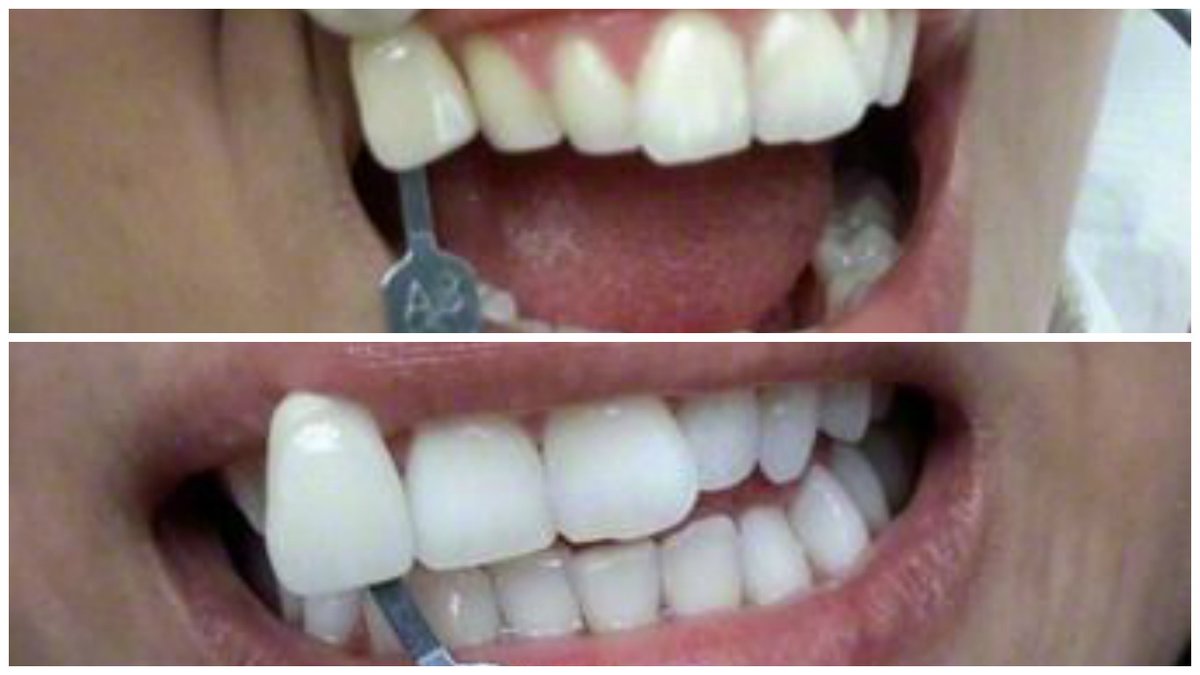 Dental Studio Spa - Dental Studio Spa