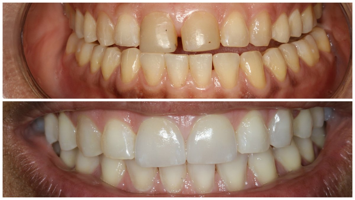 Dental Studio Spa - Dental Studio Spa