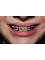 Dental Tree Jalandhar (Dental Implants & Invisible Braces Specialty Centre) - Dental Tree Jalandhar (Dental Implants & Invisible Braces Specialty Centre)