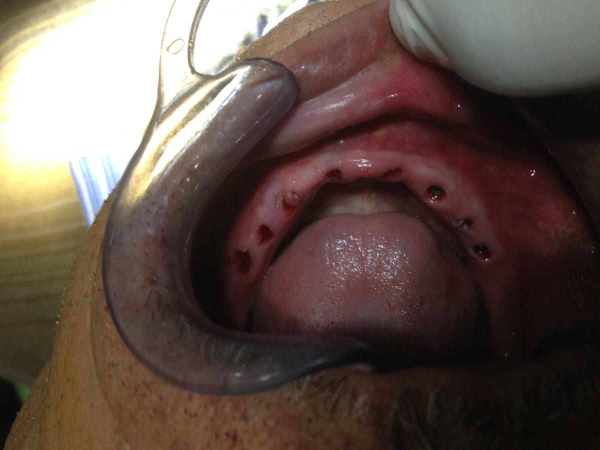 Dental Tree Jalandhar (Dental Implants & Invisible Braces Specialty Centre) - Dental Tree Jalandhar (Dental Implants & Invisible Braces Specialty Centre)