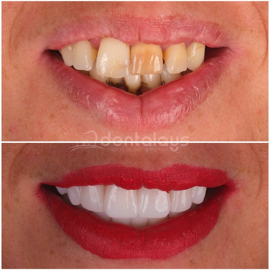 DentalAYS Dental Center - DentalAYS Dental Center