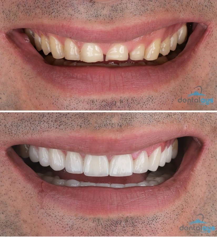 DentalAYS Dental Center - DentalAYS Dental Center