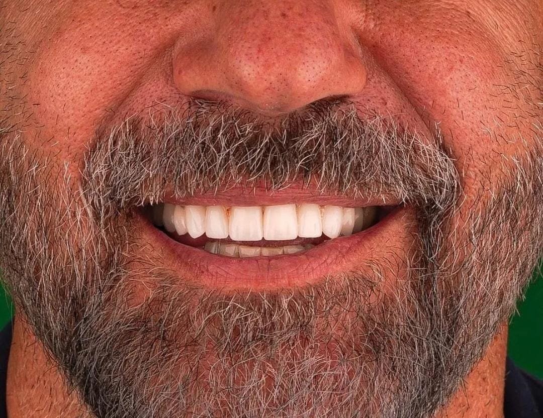 Dentaliva Ağız ve Diş Sağlığı Polikliniği - Dentaliva Ağız ve Diş Sağlığı Polikliniği