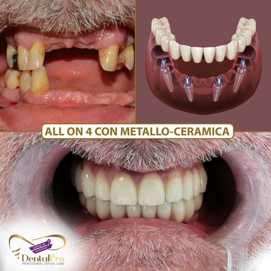 DentalPro - DentalPro