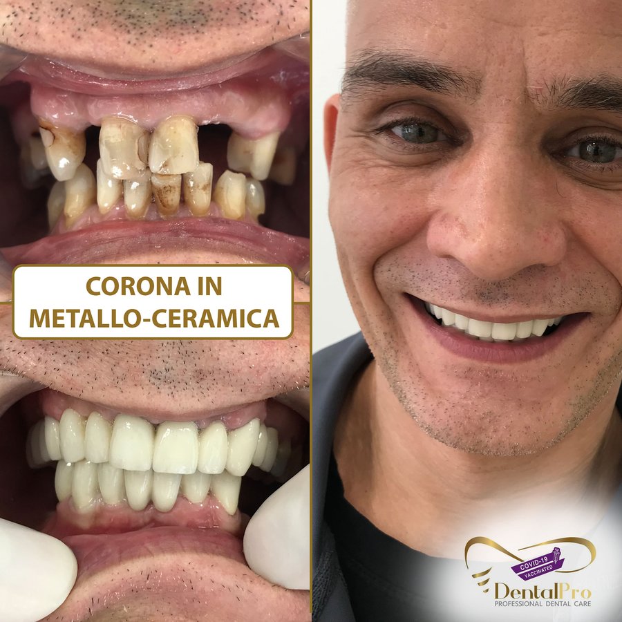 DentalPro - DentalPro