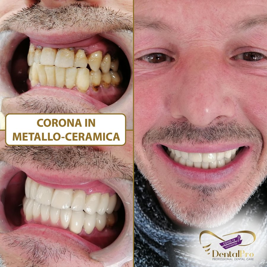 DentalPro - DentalPro