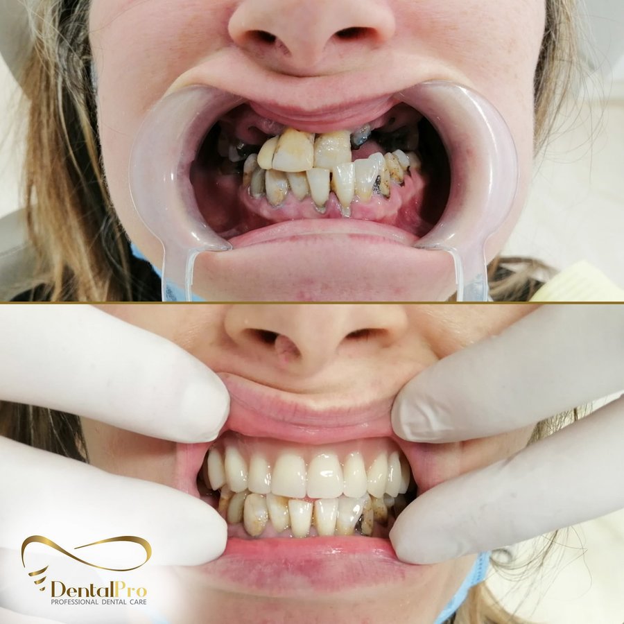 DentalPro - DentalPro