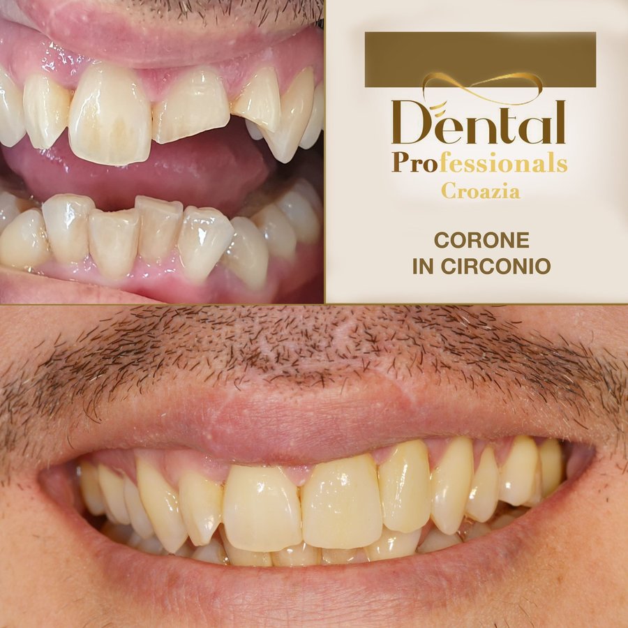 DentalPro - DentalPro