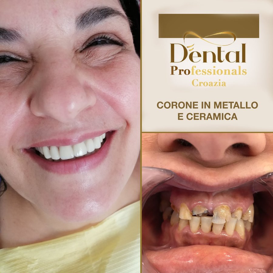 DentalPro - DentalPro