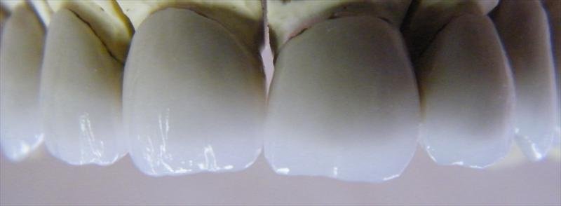 DentalTech dental labor romania - DentalTech dental labor romania