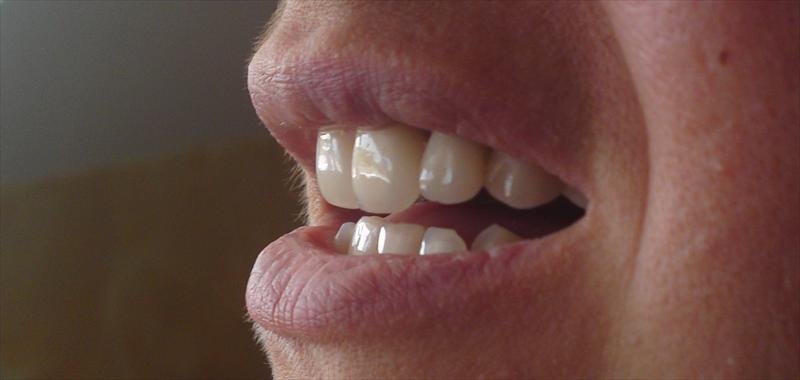 DentalTours Romania - DentalTours Romania