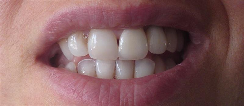 DentalTours Romania - DentalTours Romania