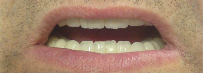 DentalTours Romania - DentalTours Romania