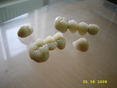 DentalTours Romania - DentalTours Romania