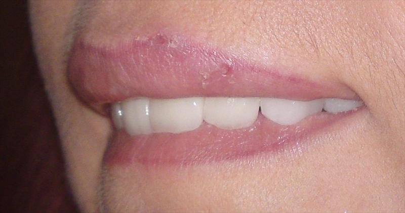 DentalTours Romania - DentalTours Romania