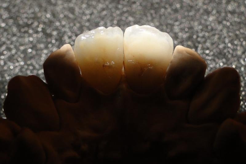 DentalTours Romania - DentalTours Romania