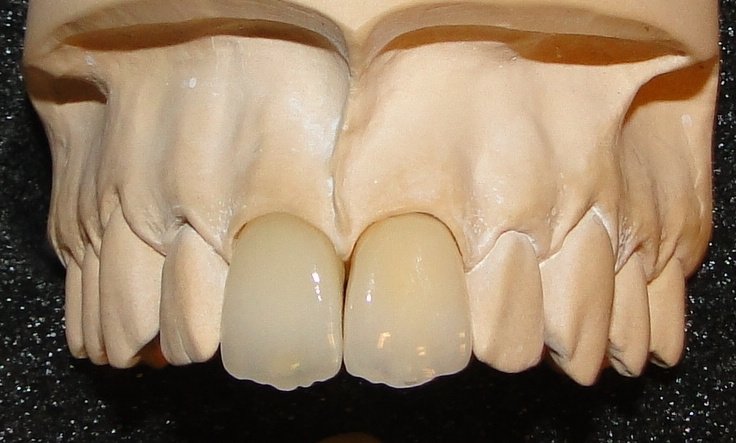 DentalTours Romania - DentalTours Romania