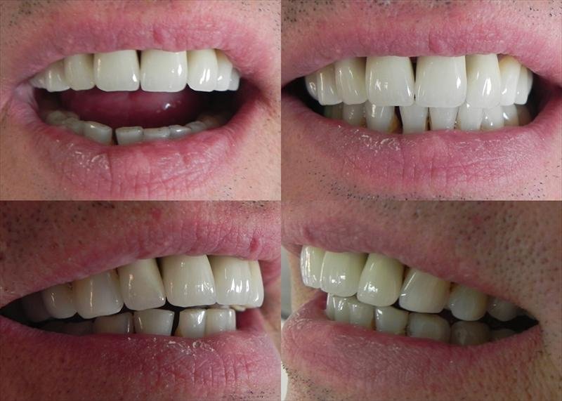 DentalTours Romania - DentalTours Romania