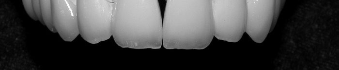 DentalTours Romania - DentalTours Romania