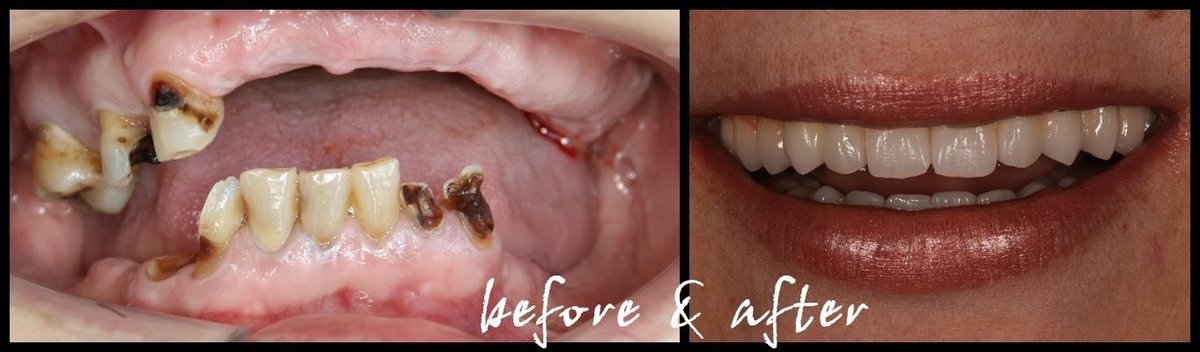 DentalTours Romania - DentalTours Romania