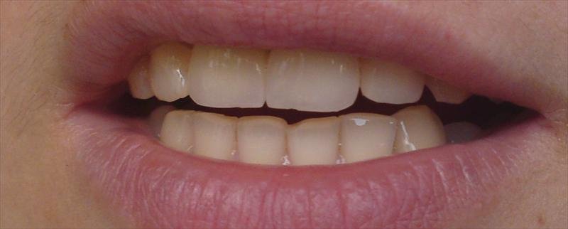 DentalTours Romania - DentalTours Romania