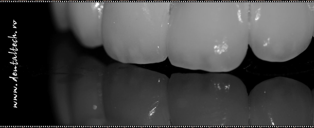 DentalTours Romania - DentalTours Romania