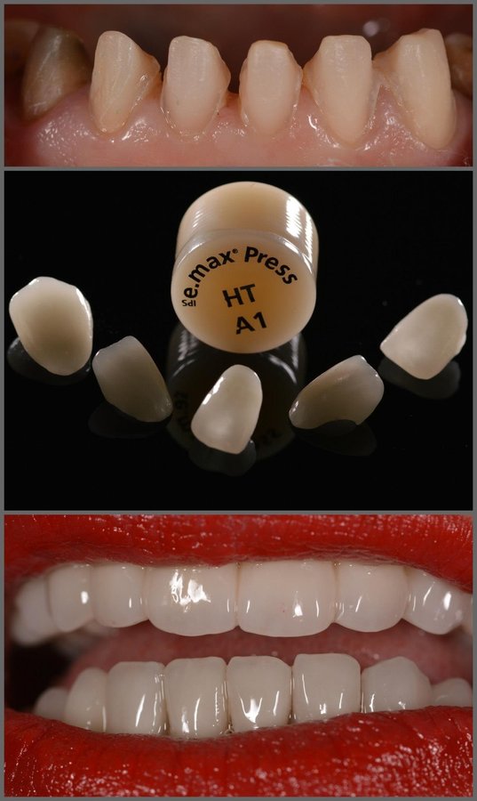 DentalTours Romania - DentalTours Romania