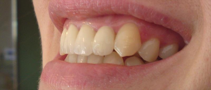 DentalTours Romania - DentalTours Romania