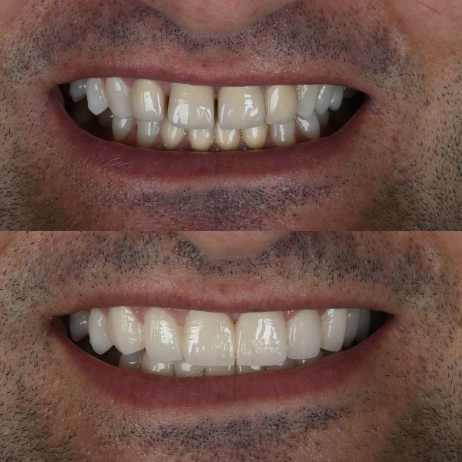 Dentares Smile Dental Clinic - Dentares Smile Dental Clinic