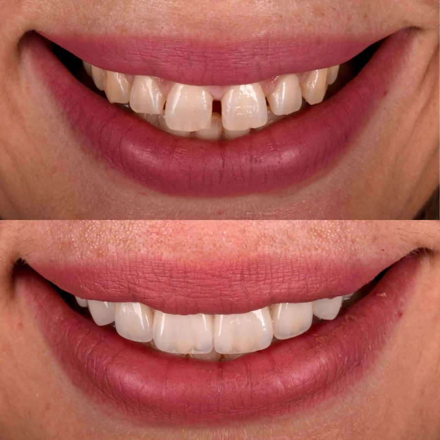 Dentares Smile Dental Clinic - Dentares Smile Dental Clinic