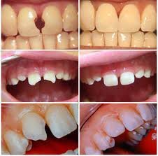 DENT-ART - DENT-ART