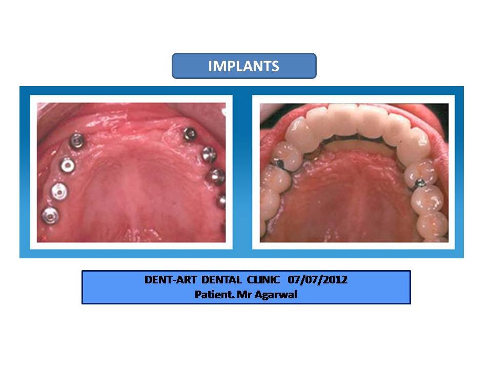 DENT-ART - DENT-ART