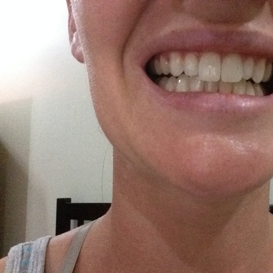 Dente Care Center - Bacolod - Dente Care Center - Bacolod