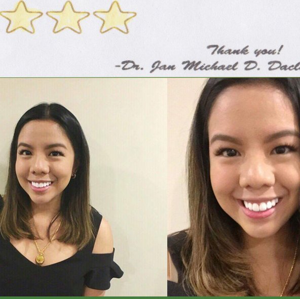 Dente Care Center - Bacolod - Dente Care Center - Bacolod