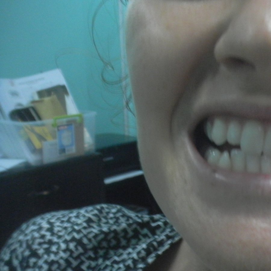 Dente Care Center - Bacolod - Dente Care Center - Bacolod