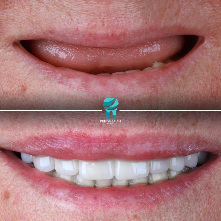 Dent-Health Istanbul - Dent-Health Istanbul