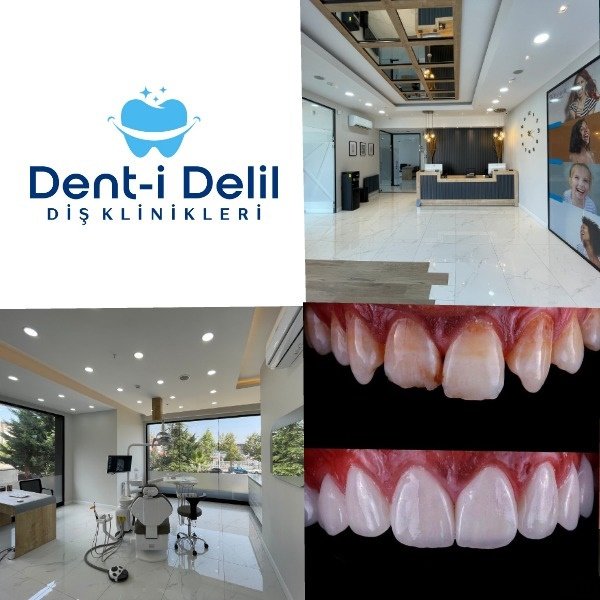 Dent-i Delil Ağız ve Dİş Sağlığı Polikliniği - Dent-i Delil Ağız ve Dİş Sağlığı Polikliniği