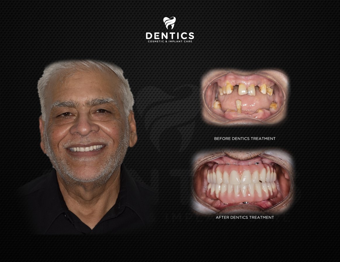 Dentics Cancun - Dentics Cancun