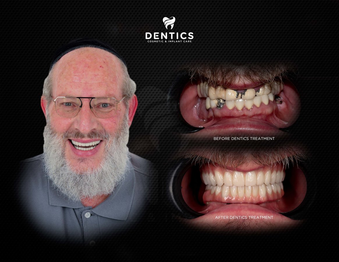 Dentics Cancun - Dentics Cancun