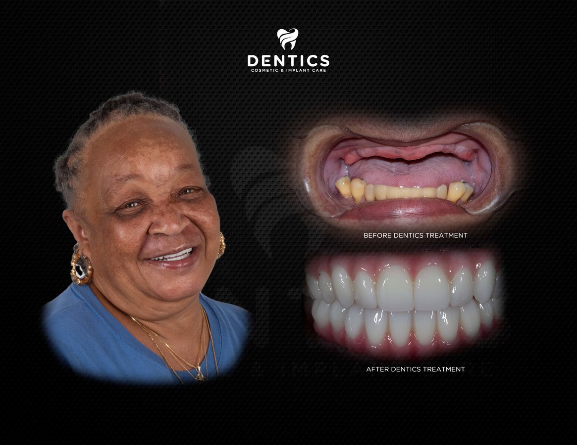 Dentics Cancun - Dentics Cancun