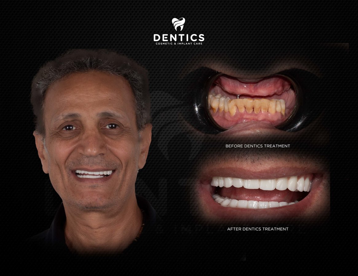 Dentics Cancun - Dentics Cancun